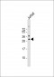 MEOX1 Antibody (Center)