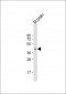 E2F3 Antibody (Center)