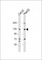 UBE4A Antibody (Center)