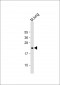 FGF10 Antibody (C-term)