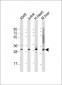 ATF5 Antibody (C-term)