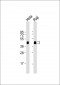 HNRNPD Antibody (N-term)