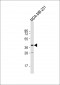 TAS2R31 Antibody (C-term)