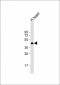 NFIB Antibody (Center)