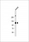 LAMP2 Antibody (Center)