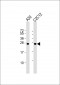 mouse BAD Antibody (Center S112/S111/Y113)