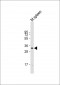 mouse CASP3 Antibody (N-term S12)