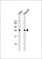 PMM2 Antibody (C-term)