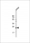 GAS41 (YEATS4/NuBI-1) Antibody (N-term F2)