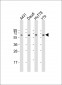 YY1 Antibody (Center)