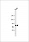 EIF4B Antibody (C-term)