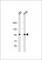 CTNNB1 Antibody(C-term)