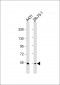 MEFV Antibody(Center)