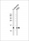 HBE1 Antibody(Center)