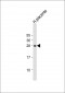 DENR Antibody (Center)