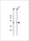 RARB Antibody (Center)