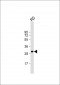 CCND2 Antibody (C-term S279/T280)