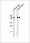 ALG6 Antibody (Center)