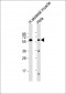 SLC29A2 Antibody (N-Term)