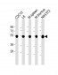 beta Tubulin