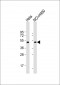 DAX1 (NR0B1) Antibody (N-term)