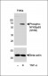 Phospho-NFKB(S536) Antibody
