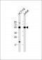 CHEK2 Antibody (N-term)