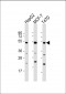 SLC9A3R1 Antibody (Center)