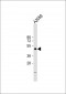 CCNE1 Antibody (C-term)