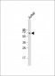 Glypican 3 (GPC3) Antibody (N-term)