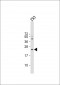 IL1RN Antibody (C-term)