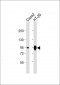 Villin-1 Antibody (N-term)