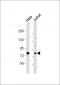 HADHA Antibody (C-term)