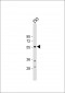 TPH1 Antibody (N-term)