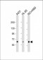 PKC eta Antibody (N-term)