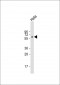 Activin Receptor Type IA (ACVR1) Antibody (Center N99)