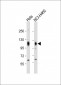 EphA4 Antibody (N-term)