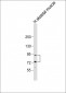 LTK Antibody (N-term)