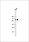 FGR Antibody (N-term)