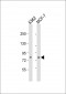 RAF1 (BRAF) Antibody (T598)