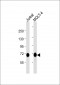 ZAP70 Antibody (Center)