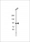 Transglutaminase (TGM2) Antibody (Center K444)