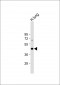 ALDH3A1 Antibody (Center)