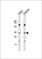 PIM2 Antibody (C-term)