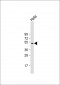 GSK3 alpha (GSK3A) Antibody (N-term)