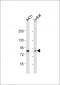 DGKA Antibody (C-term)