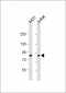 DGKA Antibody (C-term)
