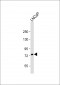 PFKL Antibody (Center K433)