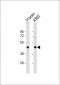 ITPKA Antibody (C-term)