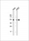 BAT1 Antibody (C-term)